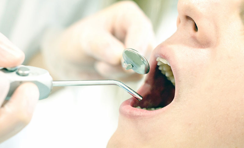 一般歯科治療-あしたばデンタルクリニック公式サイト
